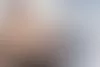 Raija tarkastaa Juho Koiviston päänahan kunnon mikrokameralla. © Vesa Tyni