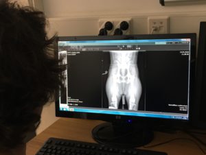 Armin A-lonkat röntgenkuvassa.