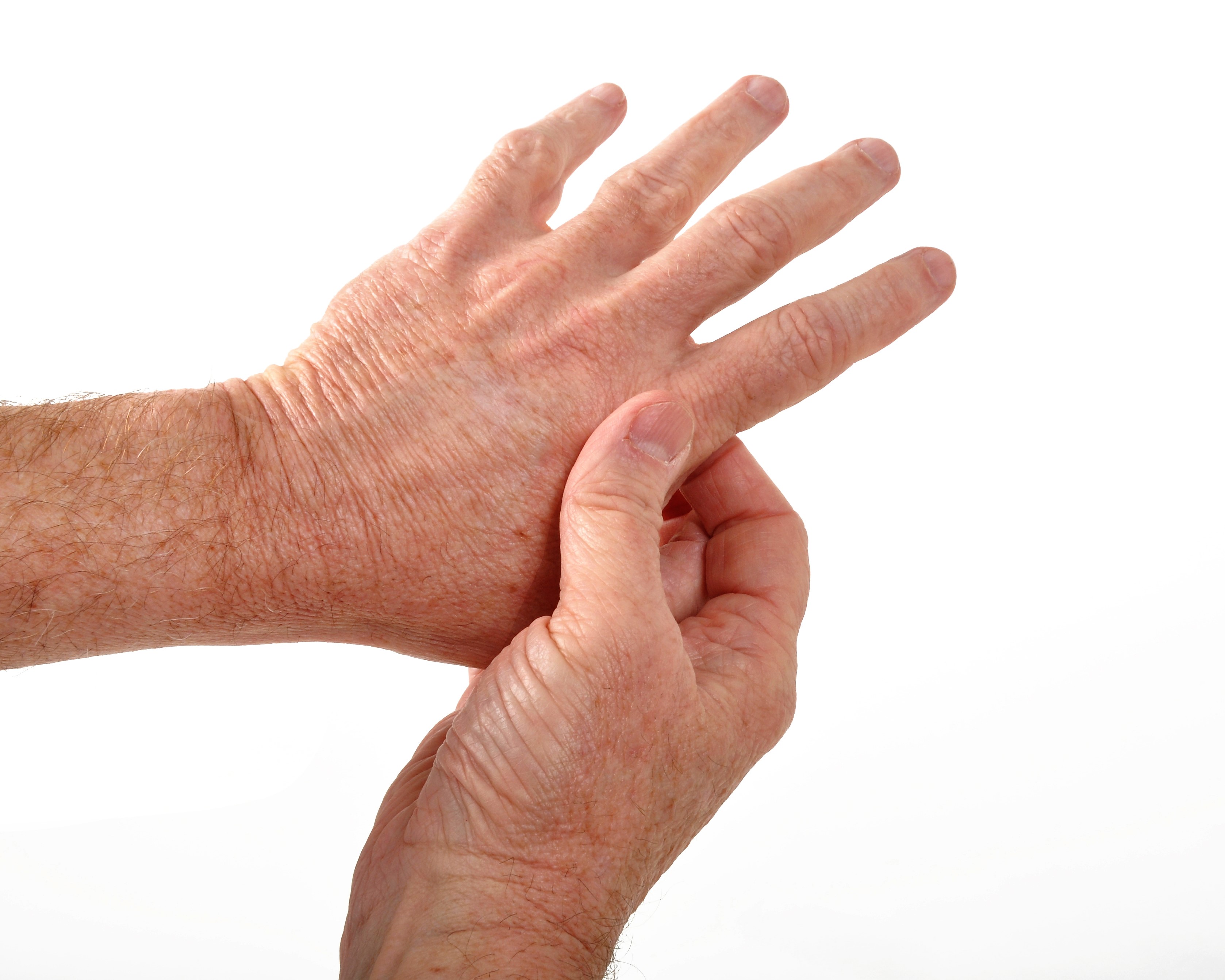 Болит сустав у основания большого пальца руки. Артрит большого пальца руки. Болит сустав на пальце руки.