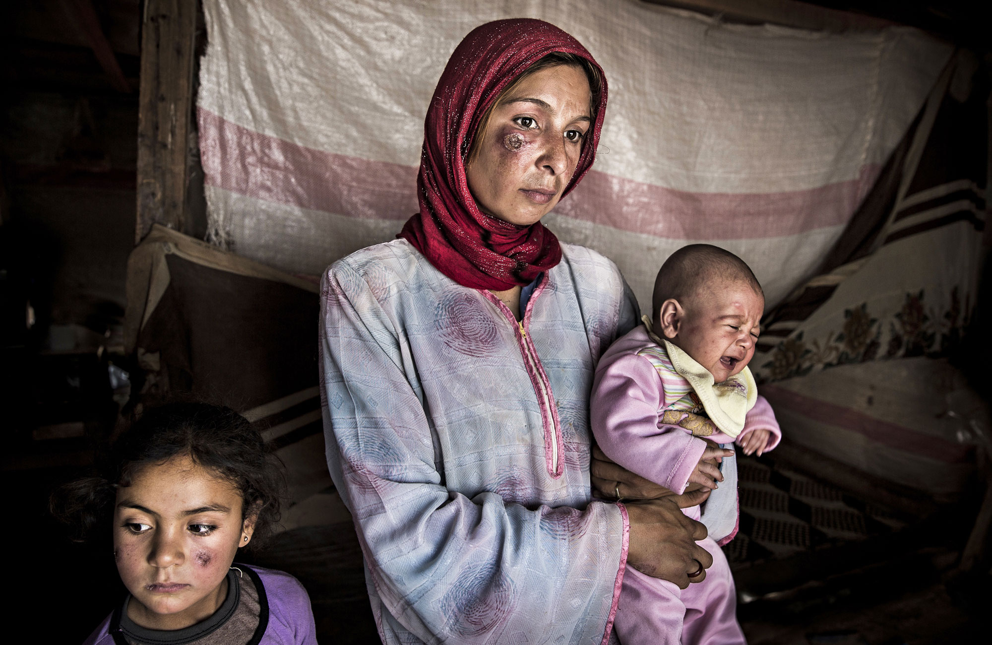 Leirioloissa leviävää “Aleppon” ihottumaa sairastava perhe Bekaan laaksossa.