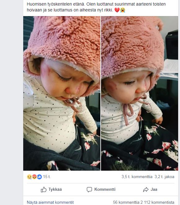 Puremajäljet näkyvät tyttären kasvoissa Jenny Linnan Facebook-postauksen kuvissa.