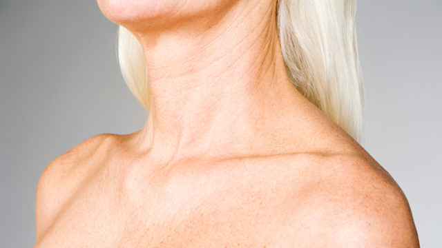 Voiko ihon ikääntymistä hidastaa purkkikollageenilla?