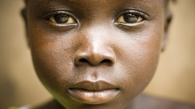 Supersalmonella leviää Afrikassa. Suurin riskiryhmä on alle 5-vuotiaat lapset.