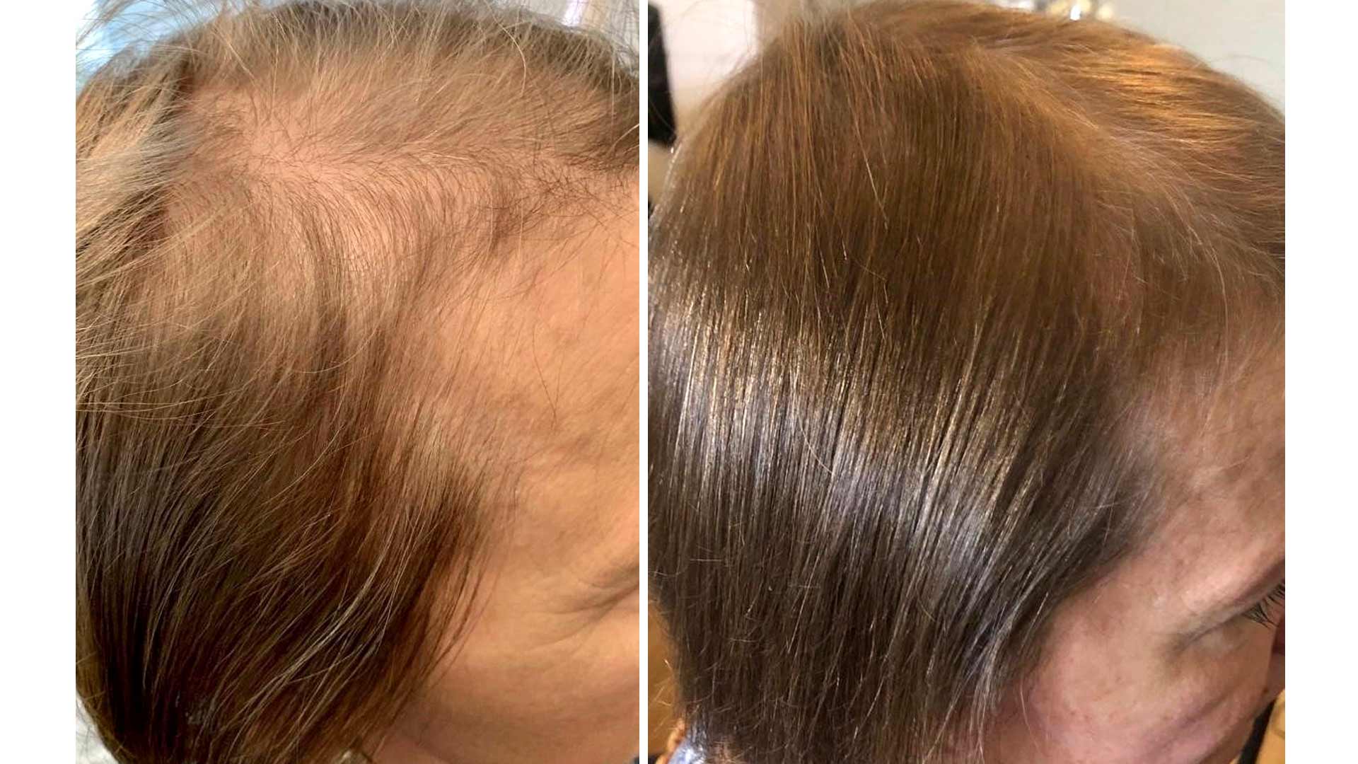 Hiukset ennen ja jälkeen.