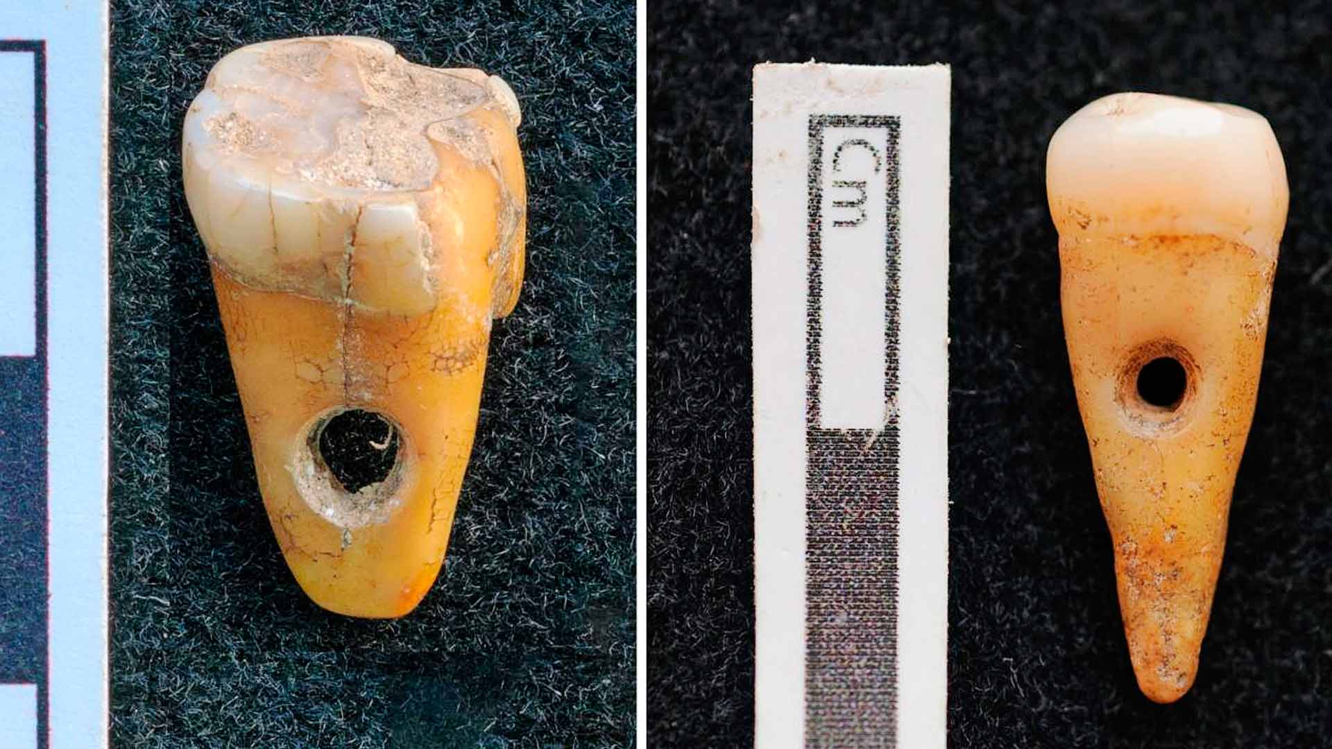 Hampaat olivat peräisin kahdelta noin 30–50 vuotiaalta henkilöltä