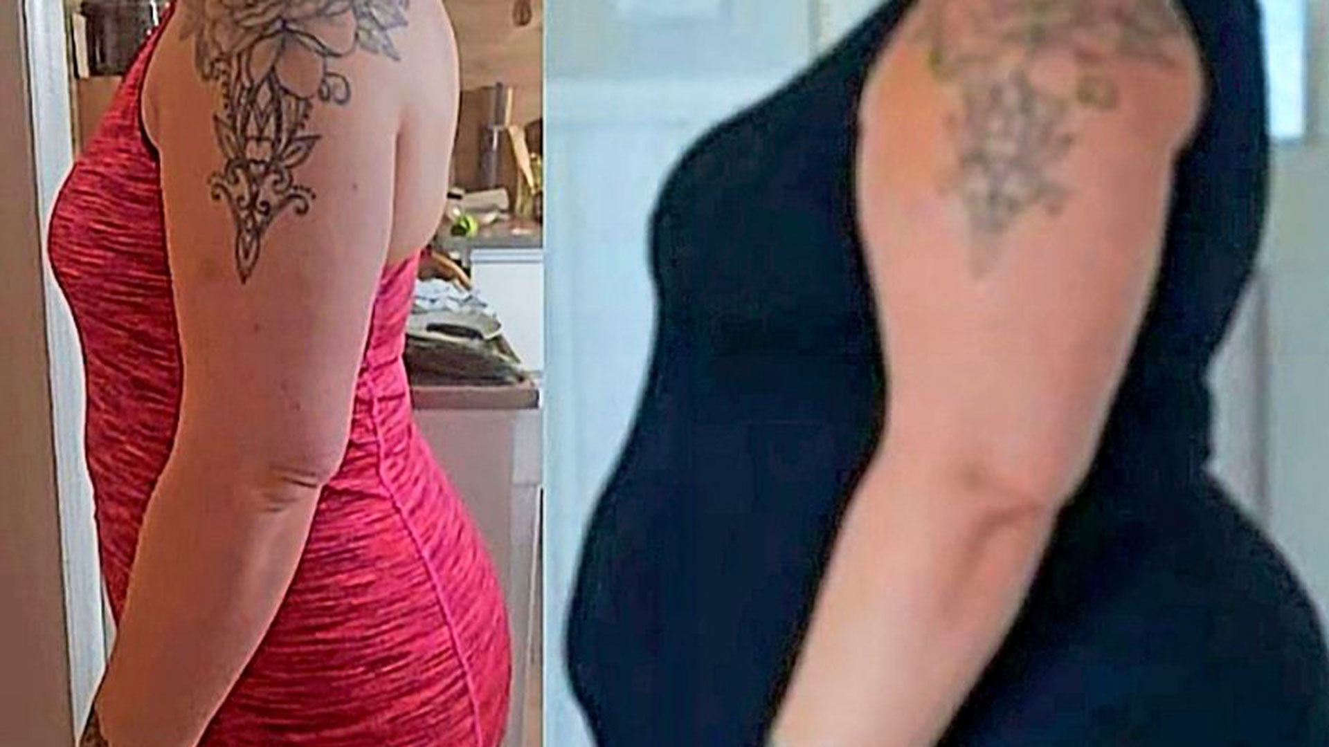Oikealla kuva Sannasta ennen ja vasemmalla jälkeen laihdutuksen.
