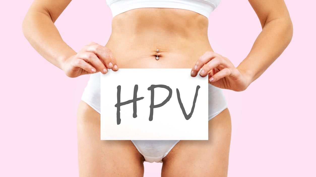 Kondylooma on erittäin herkästi tarttuva sukupuolitauti, jonka aiheuttaa Human Papilloma virus eli HPV.
